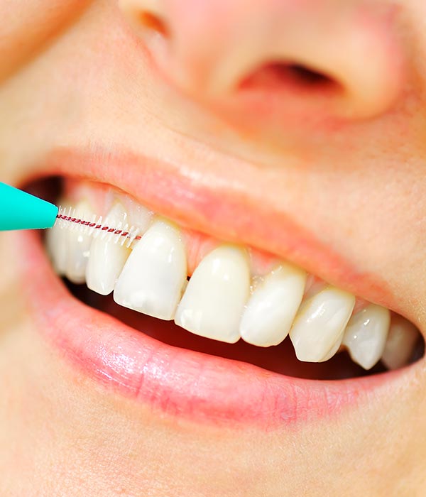 Dental Hygiene and Teeth Cleanings | Sarcee Dental | NW Calgary | General and Family Dentist